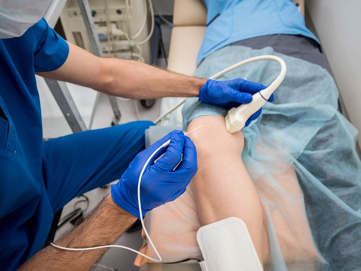 Radiofrequency Ablation (RFA)