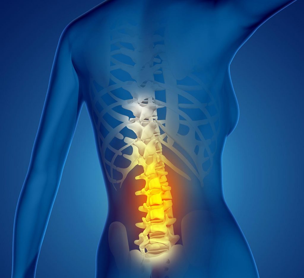 Discogenic Back Pain