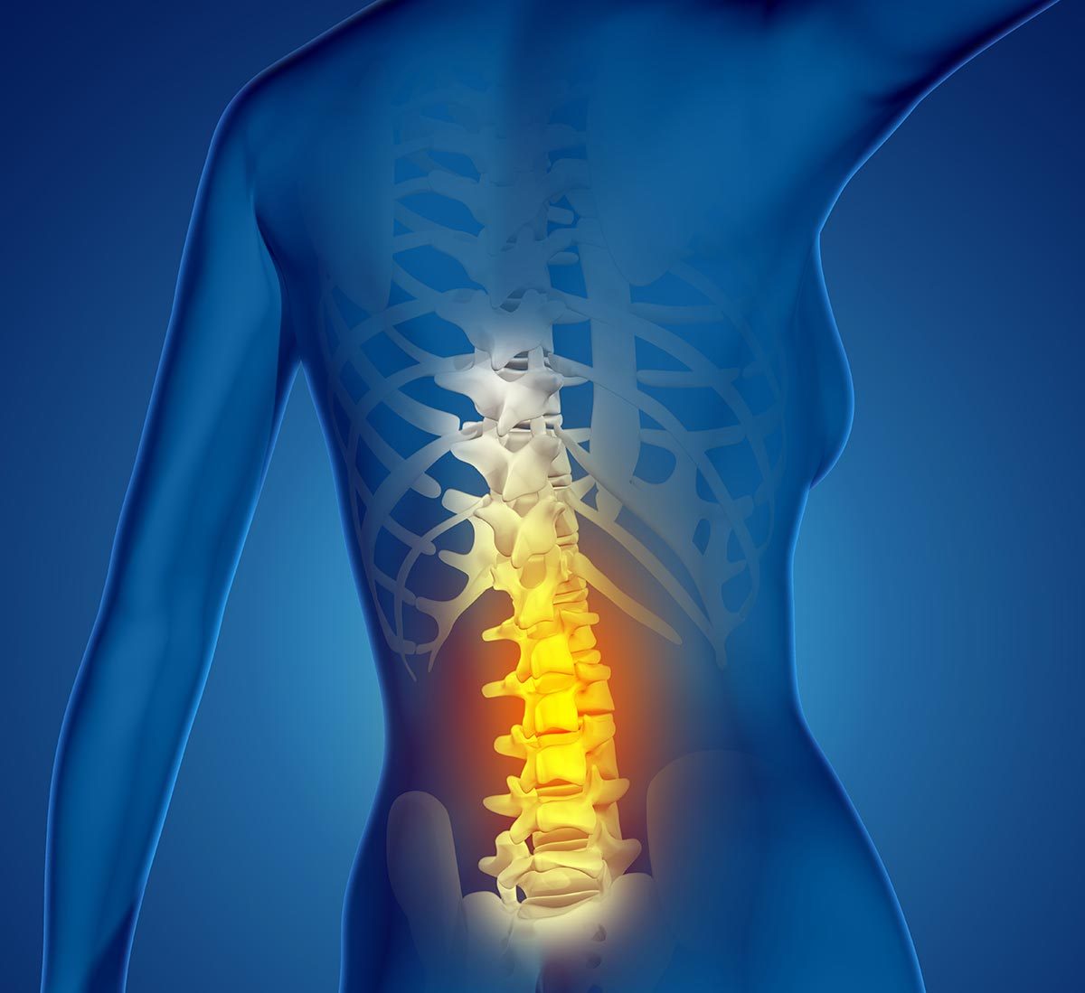 Discogenic Back Pain