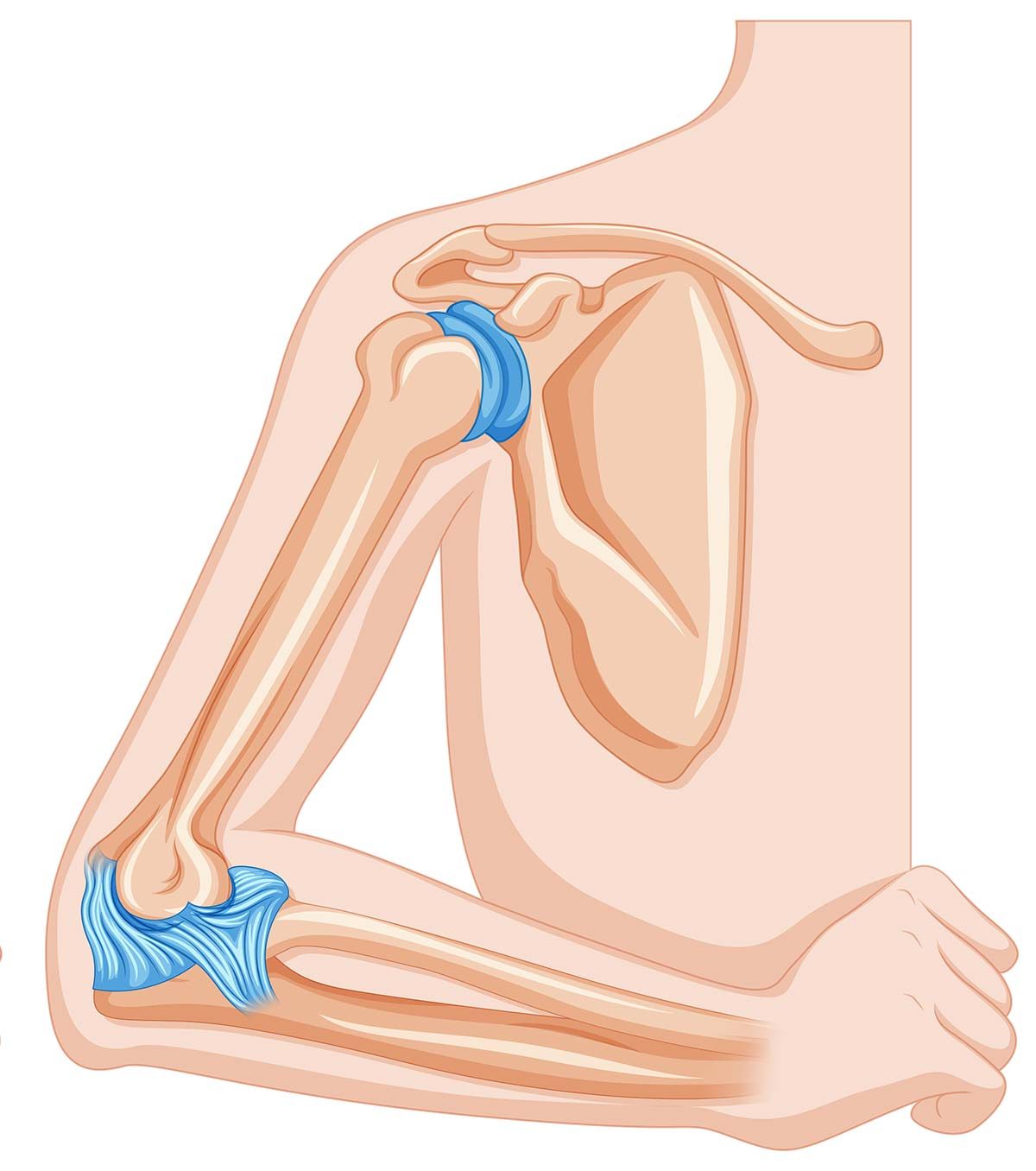 Joint Arthritis