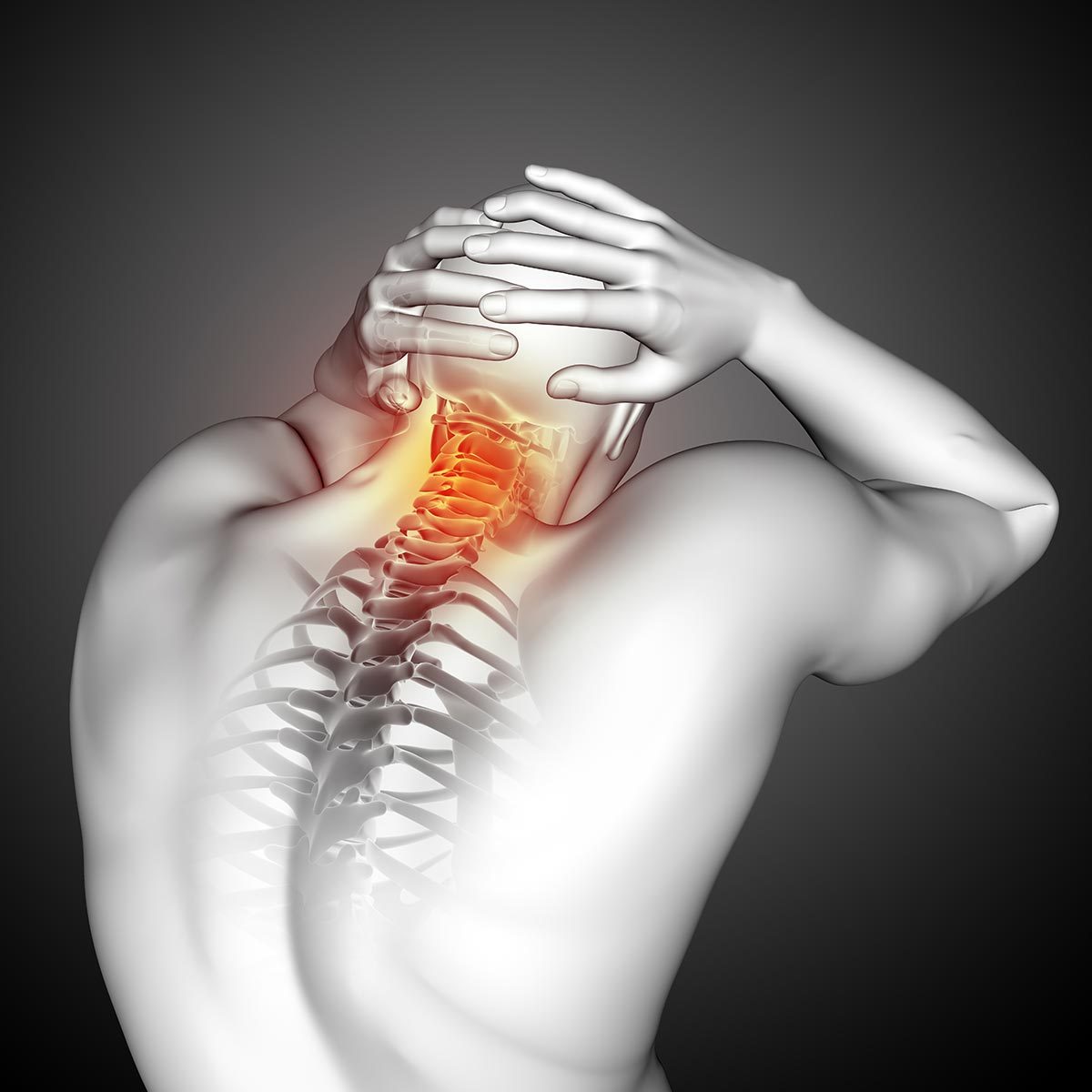 Myofascial Pain Syndrome (MPS)