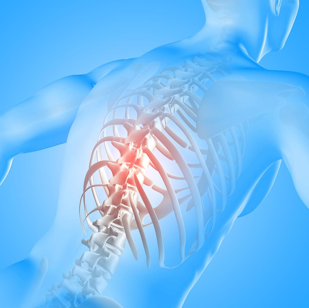 Spinal Osteoarthritis