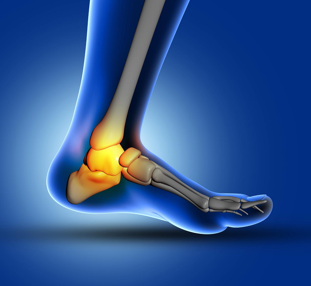 Leg sales heel pain