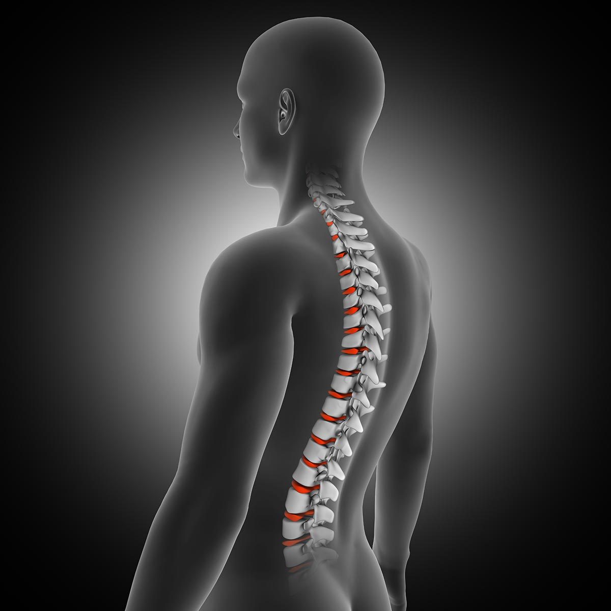 Spinal Stenosis: Treatment in Fairfax, VA  SAPNA: Spine and Pain Clinic of  North America