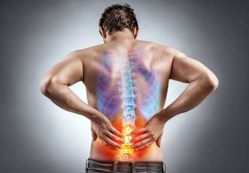 6 Effective Ways to Alleviate Sciatica