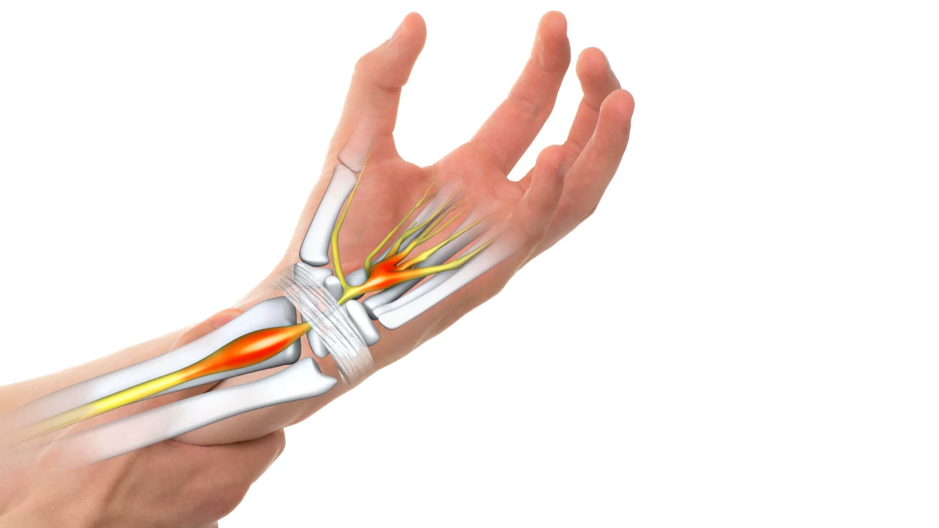 symptoms of carpal tunnel symptoms of carpal tunnel