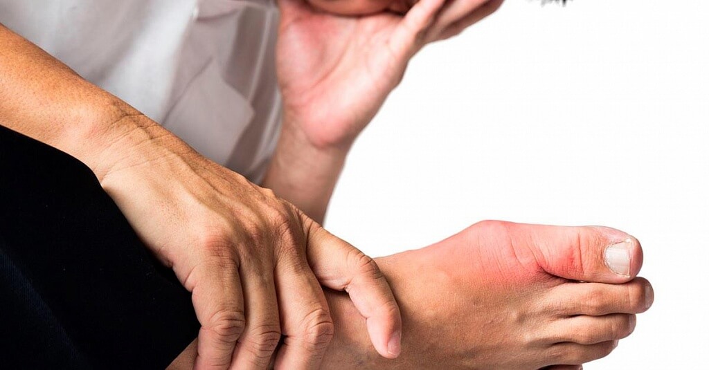 Sharp Pain in Feet: Symptoms of Arthritis in Toes