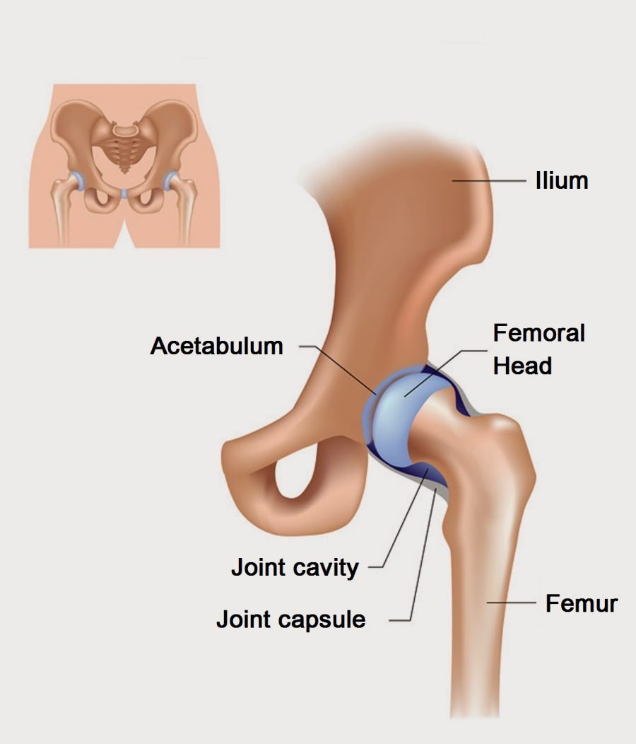 Bursitis in the hip