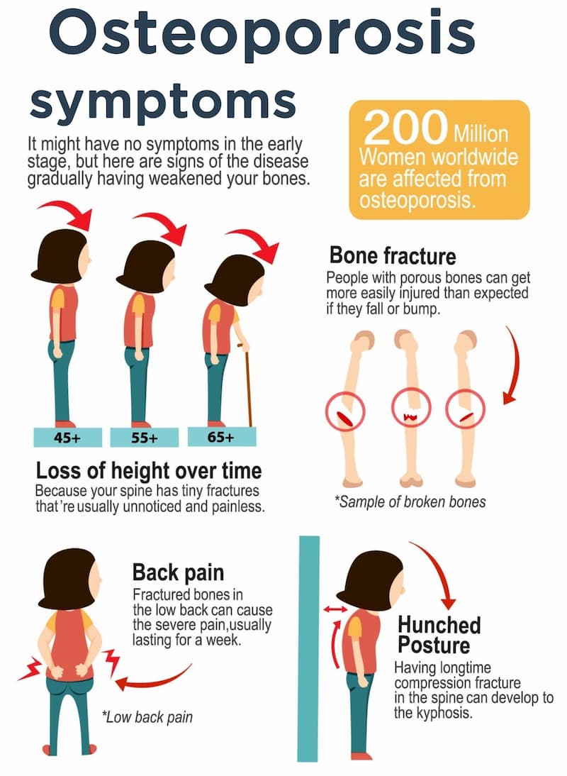 Osteoporosis symptoms