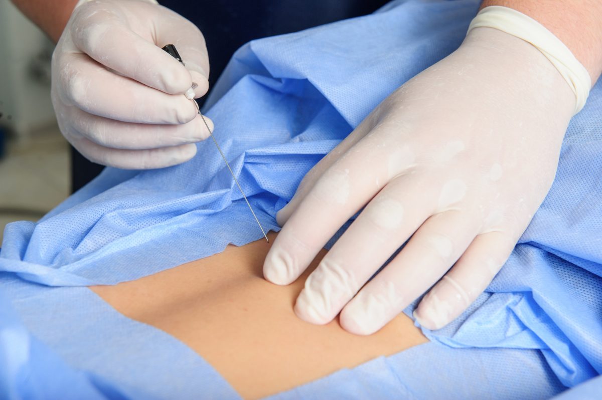 4 Amazing Spinal Injections for Pain Management