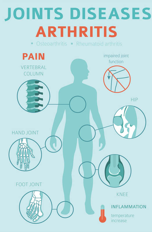 Arthritis infographic: symptoms of RA
