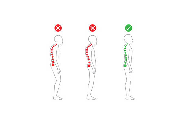 Правильные и неправильные позы при стоянии