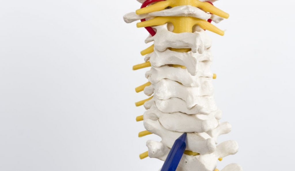How to prevent herniated disc issues