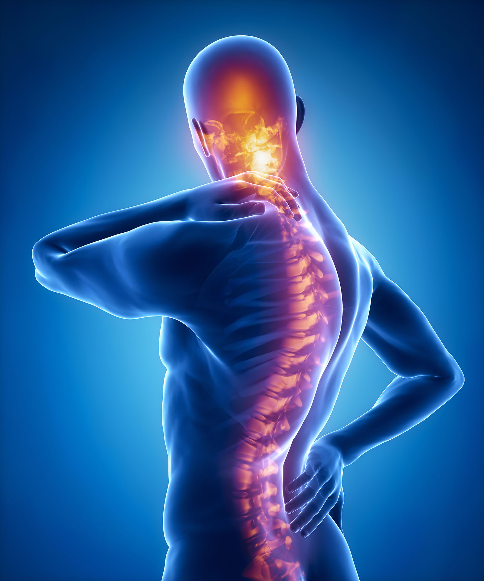 Scheuermann's Disease: Treatment in Fairfax, VA | SAPNA: Spine and Pain