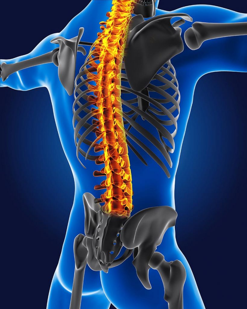 Myelopathy