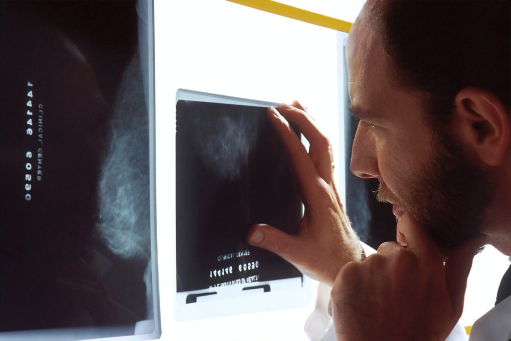 x ray identifies issues with the vertebrae and joints that comprise the spine