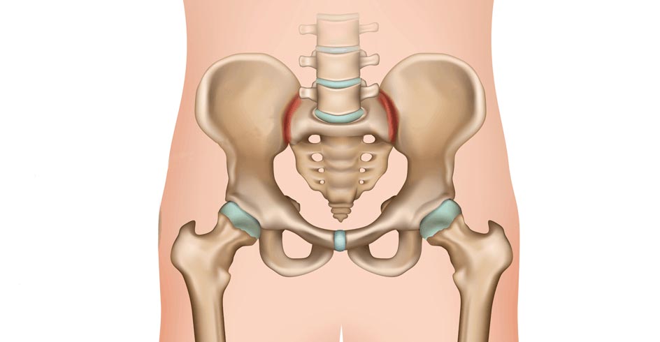sacroiliac joint fusion system spine pain clinic of north america