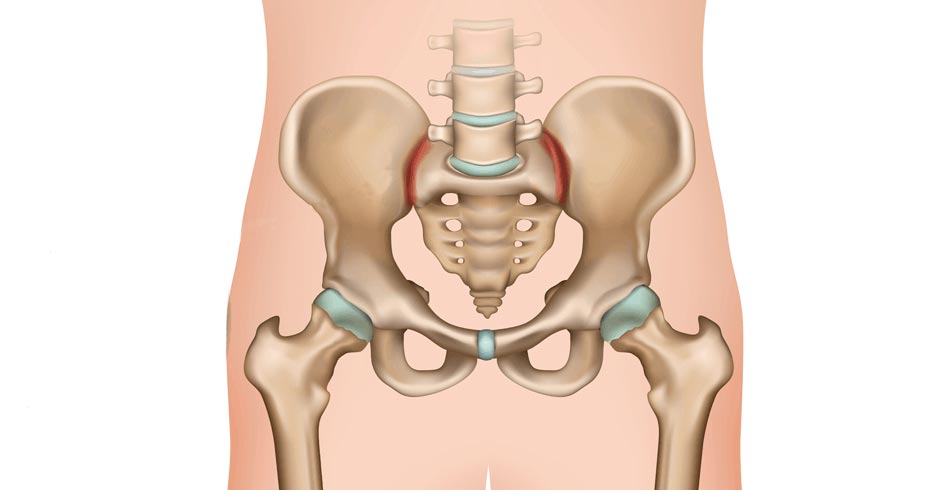 LinQ™ – Sacroiliac Joint Fusion System