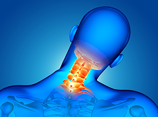 spondylosis - pain management center