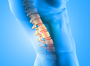 Degenerative Disc