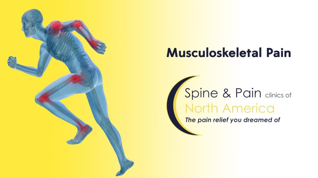 Musculoskeletal Pain: Causes, Symptoms, Diagnosing