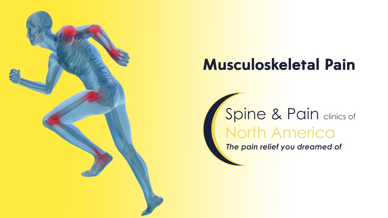Musculoskeletal Pain Treatment In Fairfax And Dulles VA SAPNA musculoskeletal-pain-treatment-in-fairfax-and-dulles-va-sapna