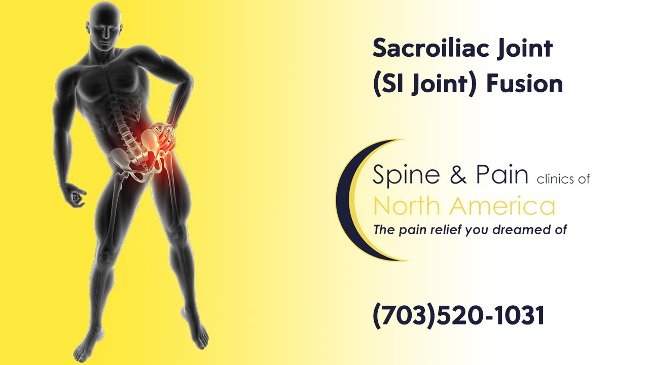 Everything You Need To Ease Sacroiliac Joint Pain