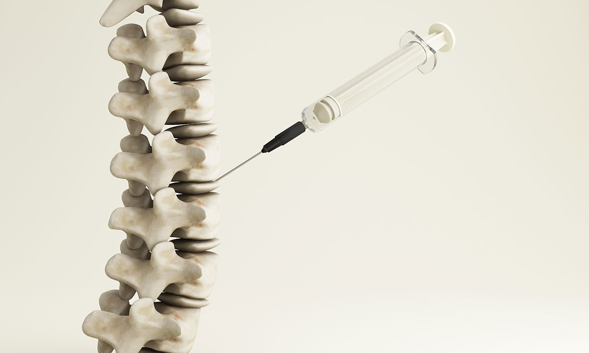 Facet Block Injection