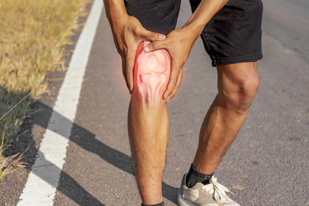 How to Heal a Sprained Knee
